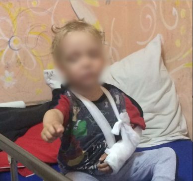 Жестоко избитый матерью ребенок лежит в больнице Калининграда. Почему молчат врачи и куда смотрят соцслужбы?