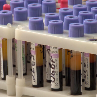 Более 1700 человек уже сдали кровь для тестирования на антитела к COVID-19