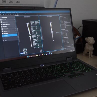 В Калининградском кардиоцентре начали применять новый вид операции по эндопротезированию коленных суставов